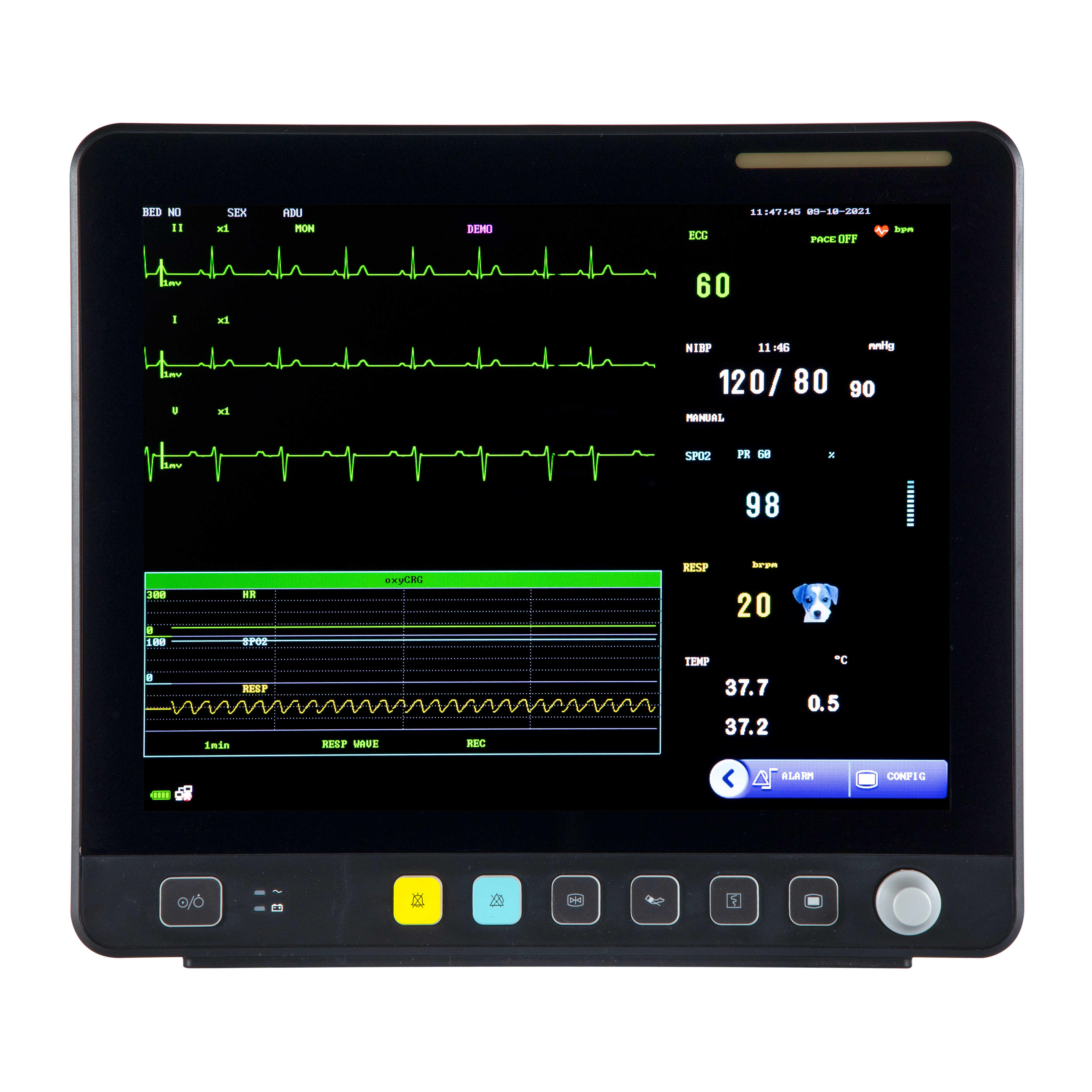 Állatorvosi érintőképernyős többparaméteres EKG-monitor VE15